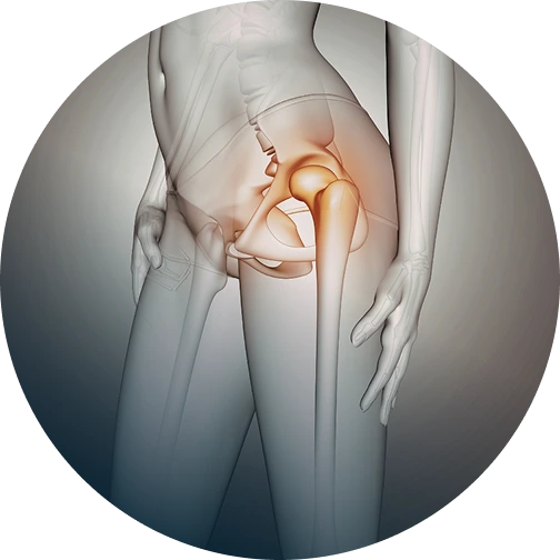 LA & Orange County Hip Labral Tear Repair