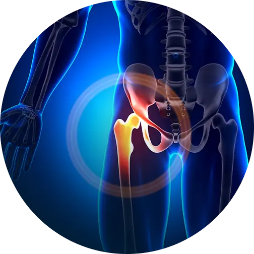 LA & Orange County Hip Replacement Surgeon