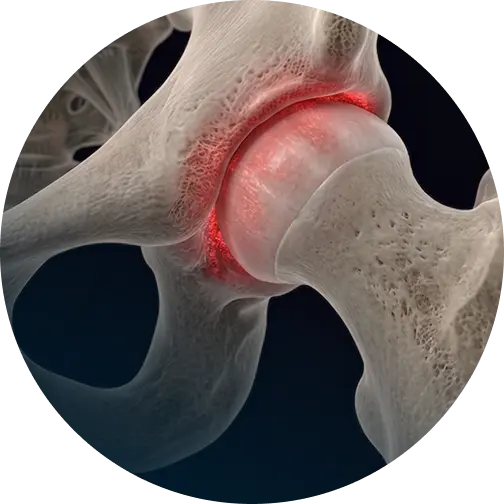 LA & Orange County Hip Labral Tear Repair